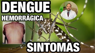 SINTOMAS DA DENGUE HEMORRÁGICA [upl. by Fia]