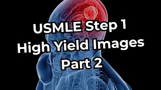 USMLE Step 1 High Yield Images Part 2 REFRESHED [upl. by Summers]