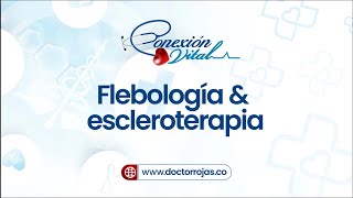 Flebología amp escleroterapia [upl. by Boonie]