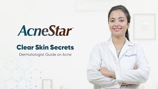 Warning Common mistakes about acne  AcneStar Gel  AcneKaSpecialist  Ft Dr Anupriya Goel [upl. by Annaiel]