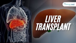 All about Liver Transplant  Who needs Liver Transplant [upl. by Earal834]