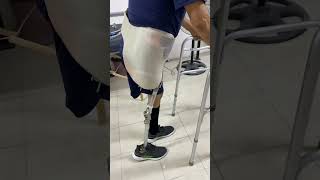 amputee rehab gait prosthetics artificiallimb artificiallimbcenter shorts [upl. by Akvir]