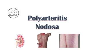 Polyarteritis Nodosa PAN  Signs amp Symptoms Diagnosis Treatment [upl. by Hayton]