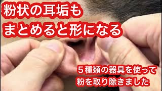 耳垢といっても粉状もあります【粉状の耳垢をキレイにするのも簡単ではありません】（理容師チャンネル） [upl. by Adnamahs859]