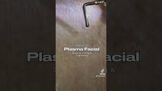 The M Day Spa Plasma Facial [upl. by Airyk]