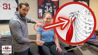 Biceps Tendinopathy  What Physical Therapists Need to Know [upl. by Cinda]