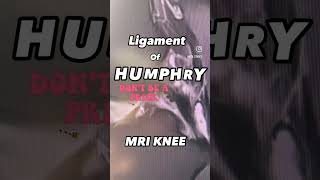 knee ligaments MRI humphrey [upl. by Lemrahc]