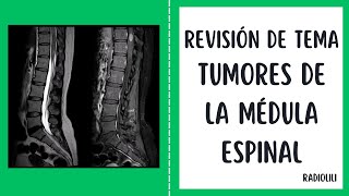 Revisión de Tema Radiológico Tumores de la Médula Espinal Aproximación Diagnóstica por Imágenes [upl. by Pizor]