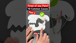 Part 2 of 2 10 Types of Jaw Pain tmj tmd jawpain jawpainrelief dentist dental [upl. by Possing]