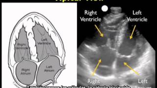 Procedimiento para realizar una ecocardiografía  Vista apical [upl. by Akemed]