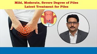 Treatment options for piles  Dr Sujay B R  Nano hospitals bengaluru [upl. by Idnek]