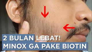 Progres Minoxidil 2 Bulan Tanpa Biotin [upl. by Eliga156]