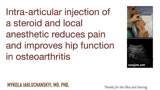 Injection of a steroid and anesthetic reduces pain and improves hip function in osteoarthritis [upl. by Elocin]