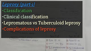 Leprosy Part1  Classification  Complications of leprosy  Lepra reactions  Microbiology [upl. by Mure]