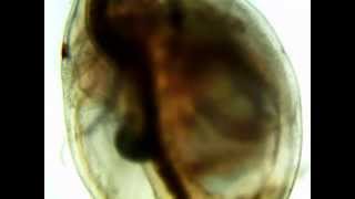 Daphnia Heart Rate Diphenhydramine [upl. by Adrahs]