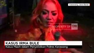 Hasil Autopsi Pedangdut Irma Bule [upl. by Armilda]