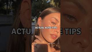 6 Actual Acne Tips viralshorts acnetreatment acnescars [upl. by Joost459]