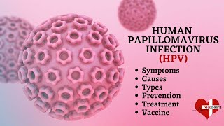 Human papillomavirus infection  HPV  What is HPV amp How do you get it [upl. by Drageruaeb]