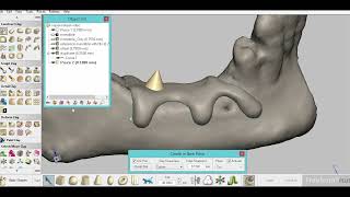 Subperiosteal Implants using Geomagic freeform and 3D printing [upl. by Siobhan]