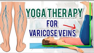 Yoga Therapy for VARICOSE VEINS  Yoga for Leg pain amp Leg cramps  Yoga for Leg Swelling  Edema [upl. by Anaeerb127]