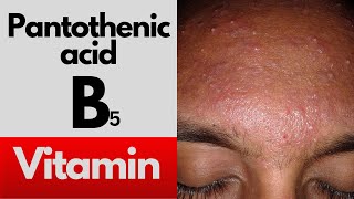 Vitamin B5 Pantothenic acid deficiency symptoms food sources and benefits of the B5 vitamin [upl. by Sum417]