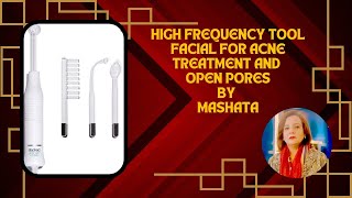 High Frequency Facial For acne treatment and reducing pores [upl. by Aryamoy]