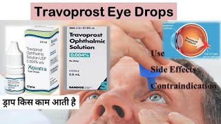 Travoprost Eye Drops  travoprost ip drops [upl. by Adnilam739]