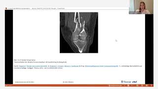 Thieme eRef – Digitales Wissensmanagement in der niedergelassenen radiologischen Praxis [upl. by Yrelle]