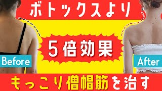 【肩背中痩せ】もっこり僧帽筋が治る！ブラのハミ肉・巻き肩・猫背撃退！ストレッチとトレーニング【ブス美】 [upl. by Gervase57]