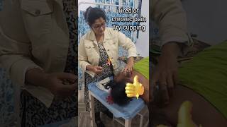 cupping cuppingtherapy  firecupping painrelief ytshorts shortsviral [upl. by Enenaj]