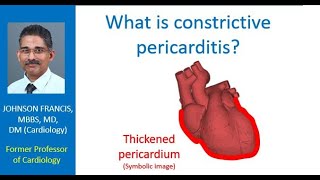 What is constrictive pericarditis [upl. by Adur]