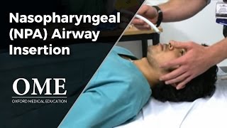 Nasopharyngeal Airway NPA Insertion [upl. by Randell]