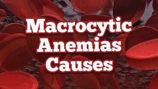 Causes of Macrocytic Anemias  Mnemonic [upl. by Orian]