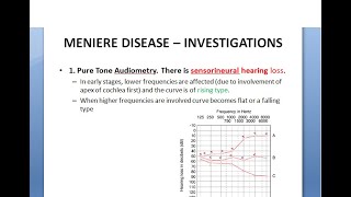 ENT Menieres Disease Part 2 Examination Investigations Diagnosis Staging Ear Check test confirm [upl. by Laban343]