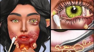 ASMR CARE ANIMATION COLLECTION  Blackhead  Sebum  Stye  Piercing  Eye [upl. by Raye]