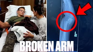 NOT WHAT WE MEANT BY FALL BREAK  BROKEN ARM  BOTH BONES BROKEN AT WRIST  BROKEN BONE ACCIDENT [upl. by Kcorb]