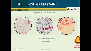 Cerebrospinal fluid Routine Analysis Microbiology Hematology and ChemistrySerology [upl. by Atsyrk571]