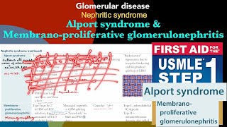 Alport syndrome amp Membranoproliferative glomerulonephritis in HindiUrdu by first aid for step 1 [upl. by Holle]