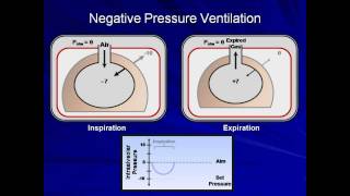 An Introduction to Mechanical Ventilation Mechanical Ventilation  Lecture 1 [upl. by Trometer]