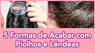 Eliminação de Piolhos e Lêndeas  Como Acabar com Piolhos e Lêndeas de Uma Vez  SOS Mamãe e Cia [upl. by Amick]