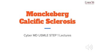 Monckeberg Calcific Sclerosis [upl. by Olivette]