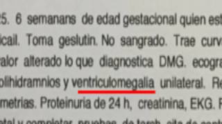 VENTRICULOMEGALIA Un Milagro Llamado Jeronimo [upl. by Ciel]