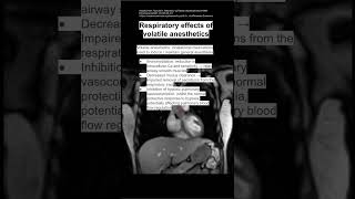 Respiratory effects of volatile anesthetics [upl. by Ahsinrats174]