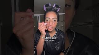 GRWM scalp eczema  eczema scars [upl. by Margit]