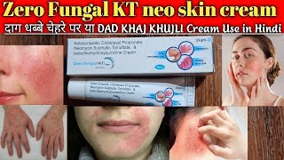 ketoconazole clobetasol propionate and neomycin sulfate tolnaftate lodochlorhydroxyquinoline cream [upl. by Nauqyaj]