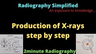 Production of Xrays l 2minute Radiography l Radiography Simplified l [upl. by Bohlen]