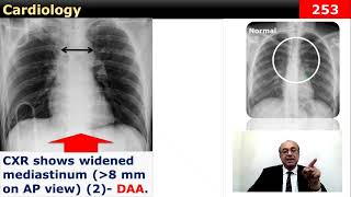 internalmedicine cme usmle محاضراتباطنة ecg كورساتباطنة clinical clinical medicine [upl. by Solly93]