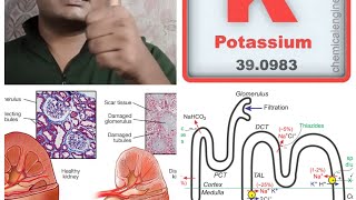 Diuretic TypesMechanismNephronKidneyBangali Doctorclinical Pharmacologist [upl. by Annola]