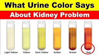 What Urine Color Says About Your Health  Understanding Urine Color and Its Causes [upl. by Dremann581]