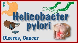 Helicobacter pylori  Physiopathologie Ulcères Diagnostic Traitement [upl. by Owens]